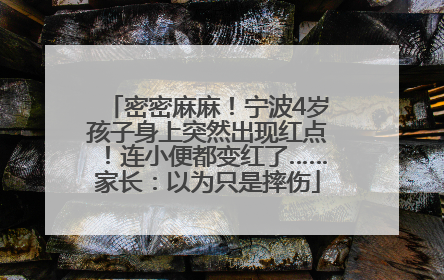 密密麻麻！宁波4岁孩子身上突然出现红点！连小便都变红了……家长：以为只是摔伤