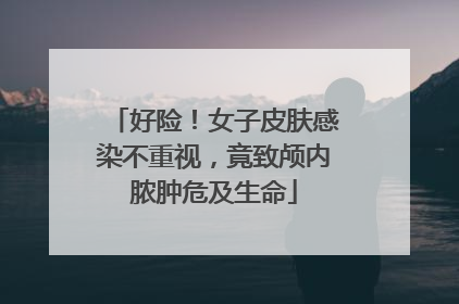 好险！女子皮肤感染不重视，竟致颅内脓肿危及生命